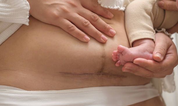 Postpartum Changes in a woman